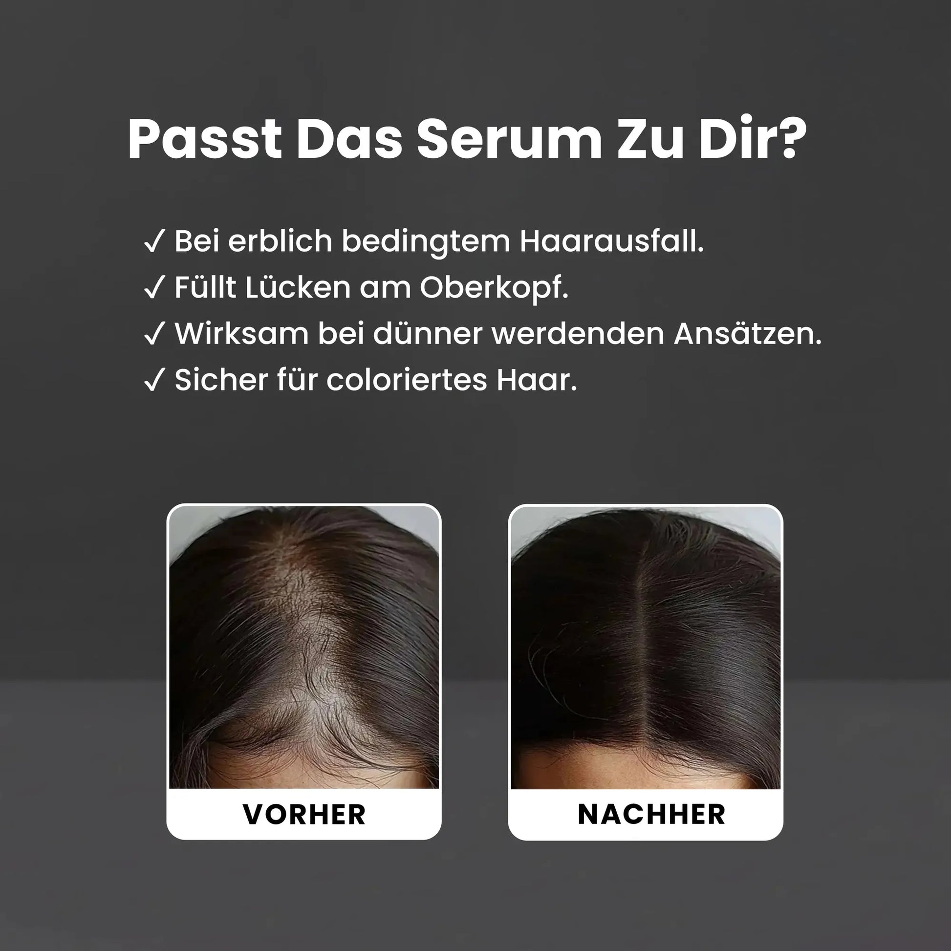 5% Redensyl Serum-Haarwuchs Aktivator Serum-Hiluva