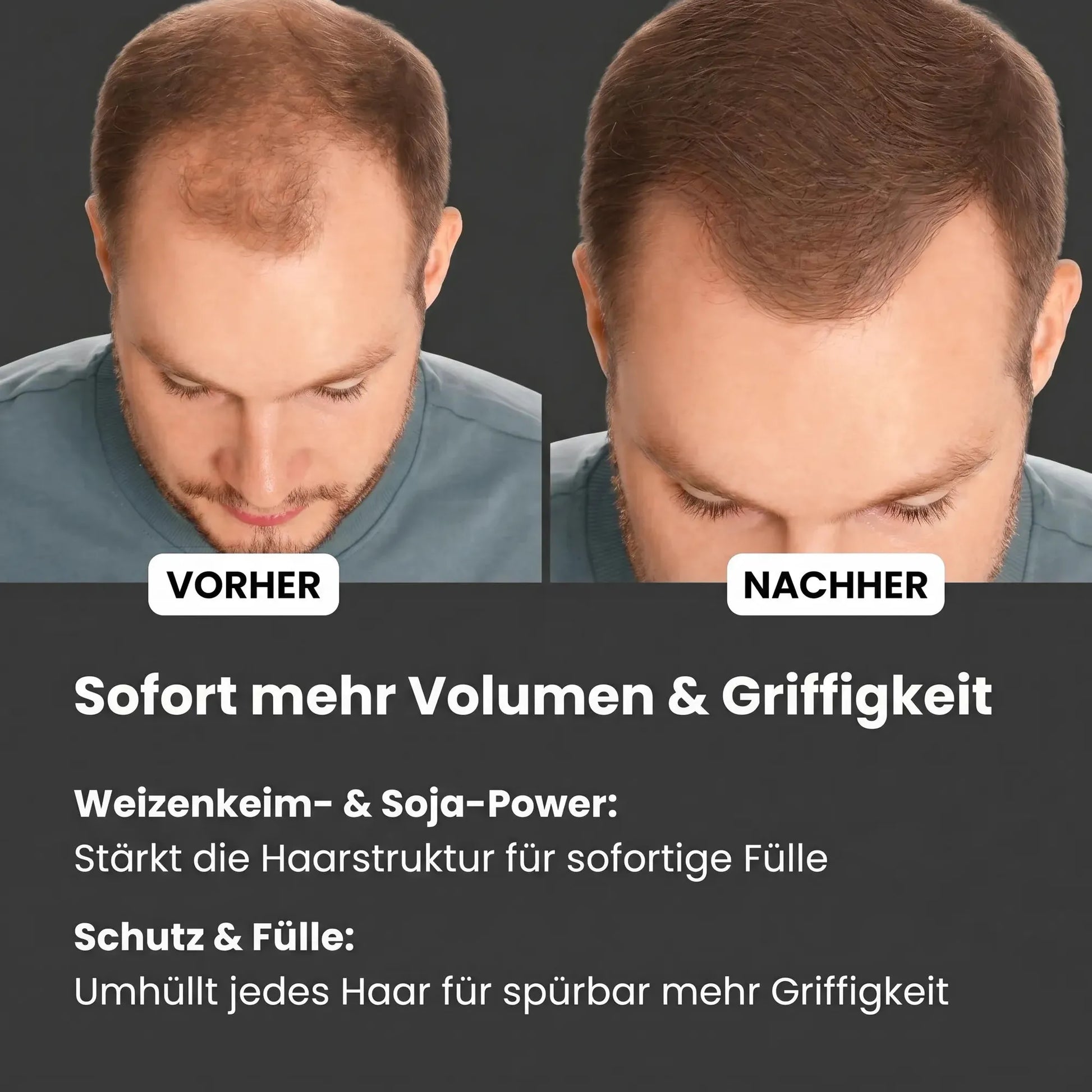 Biotin + Rosmarin MEN Schaum-Haarwuchs Aktivator Schaum-Hiluva