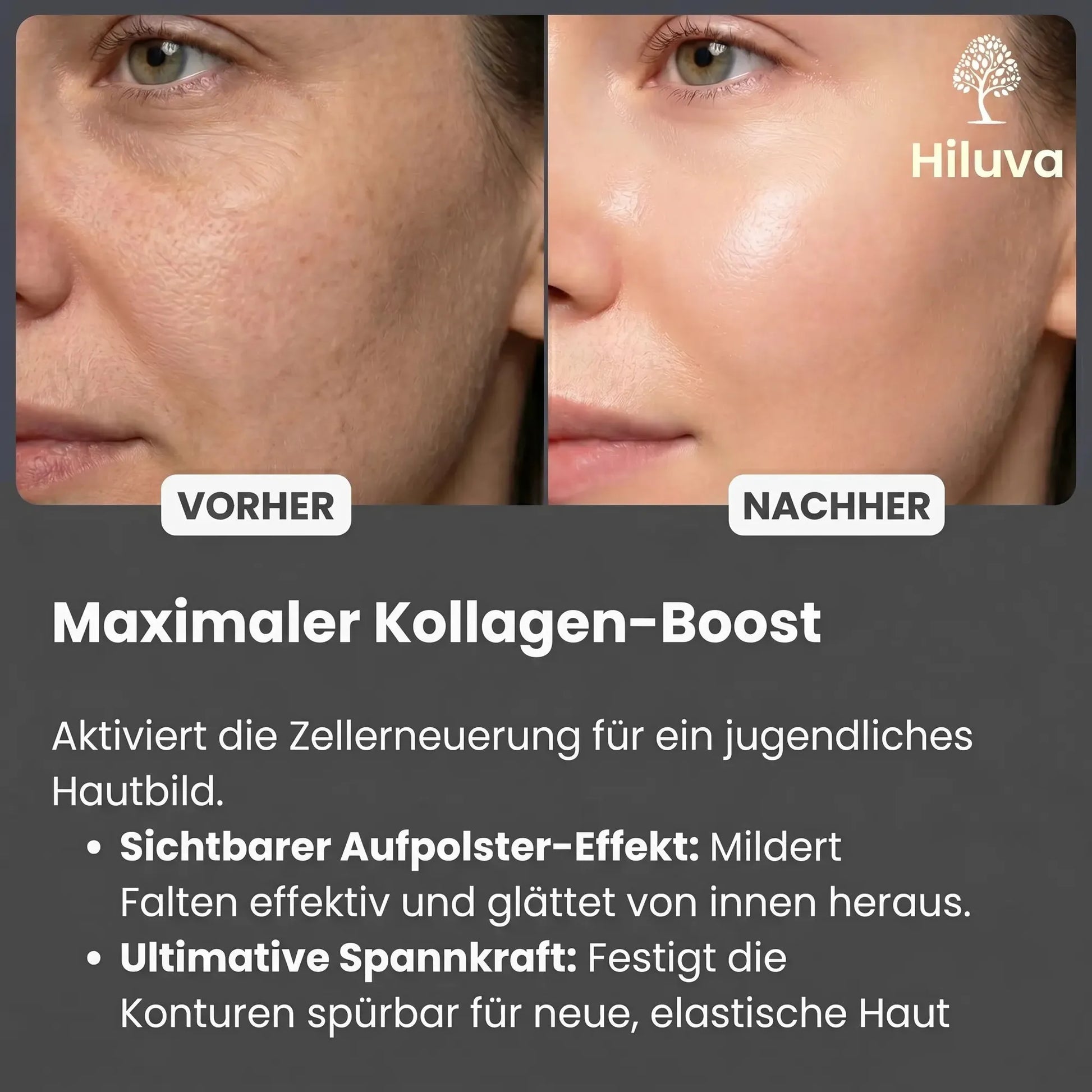 Exosomen Serum-Gesichtsserum-Hiluva