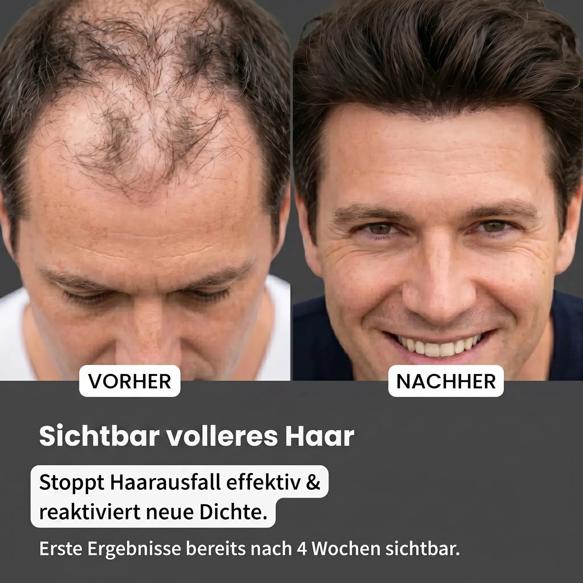 Haarwuchs Aktivator Serum-Haarwuchs Aktivator Serum-Hiluva