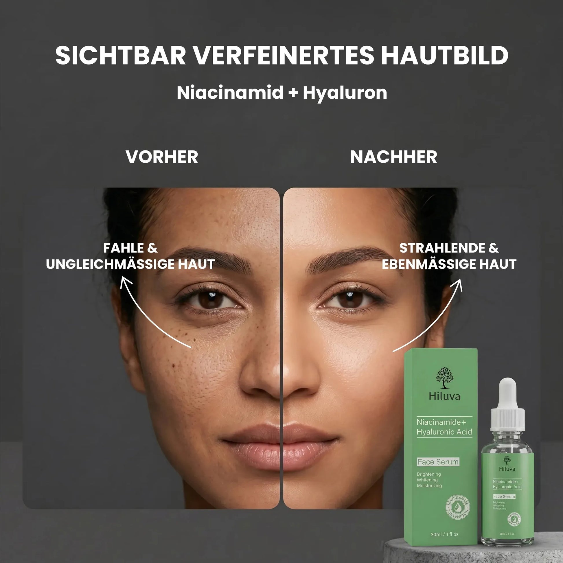 Niacinamide + Hyaluron Serum-Gesichtsserum-Hiluva